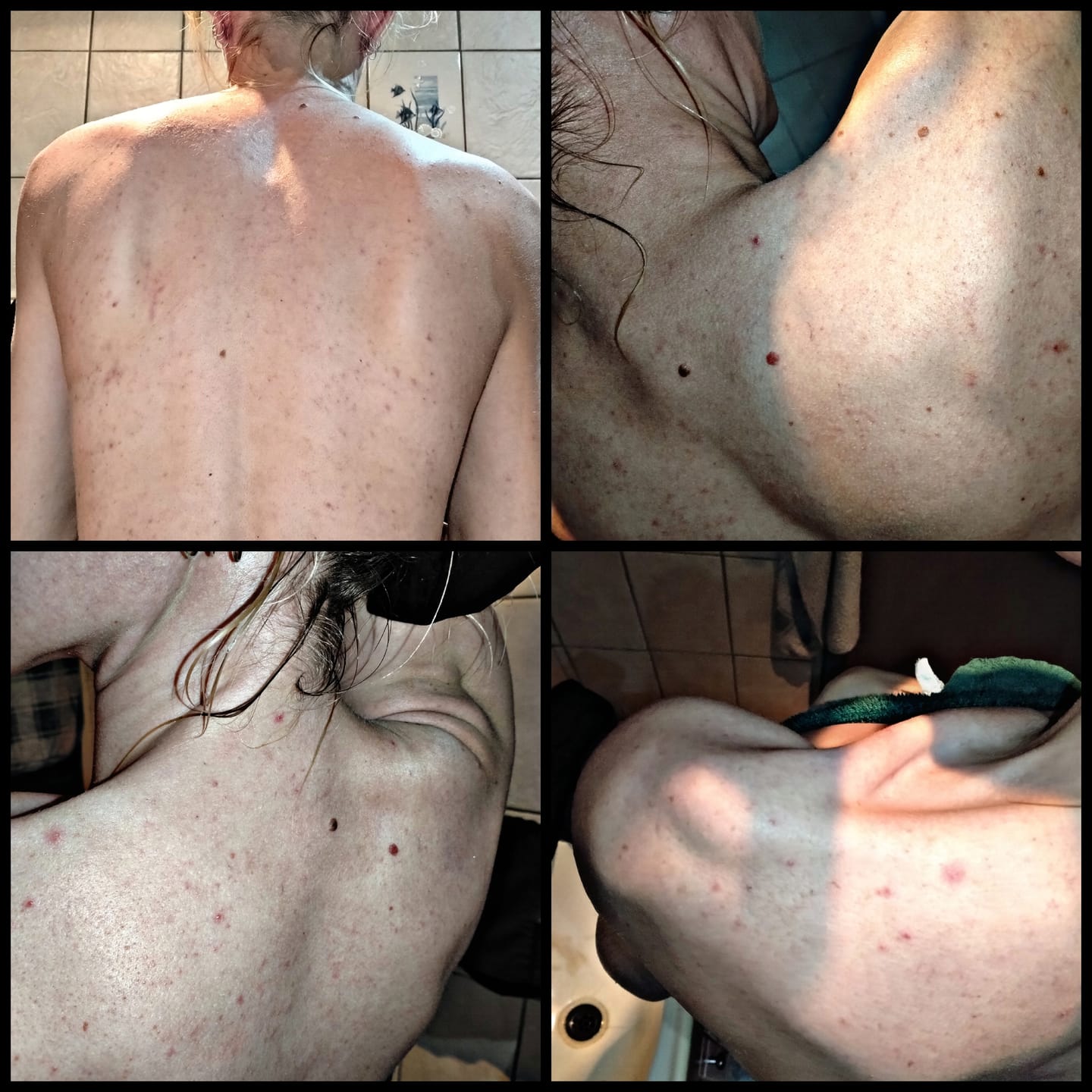 Customer photo review of Clear Skin Check