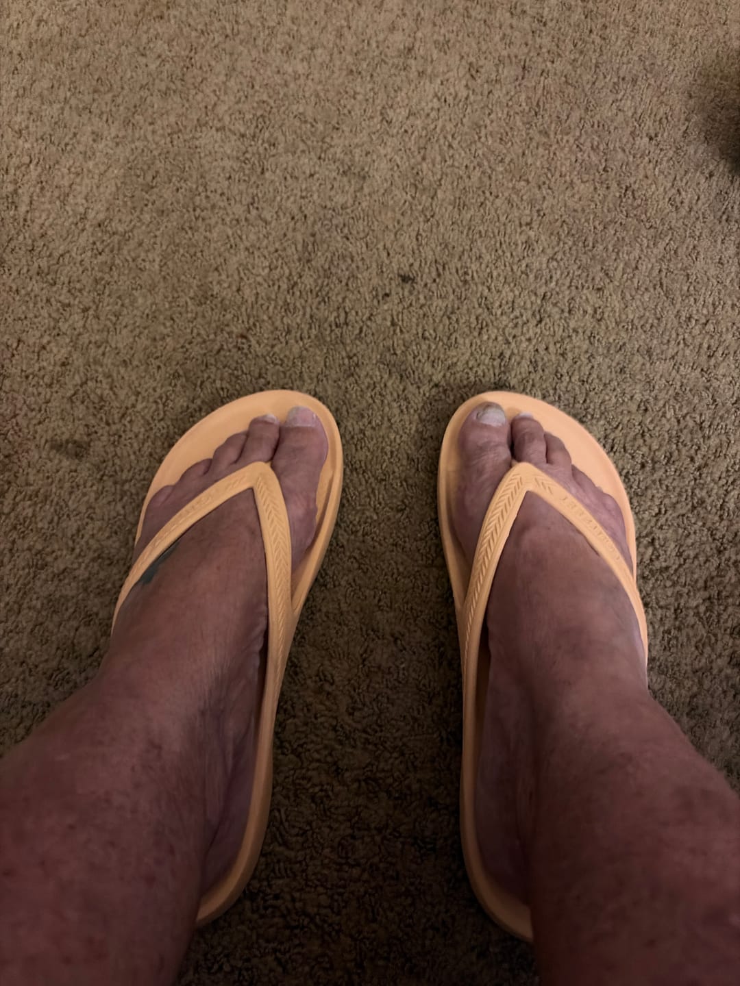 Customer photo review of Peach - Lightfeet Arch Support Flip Flops