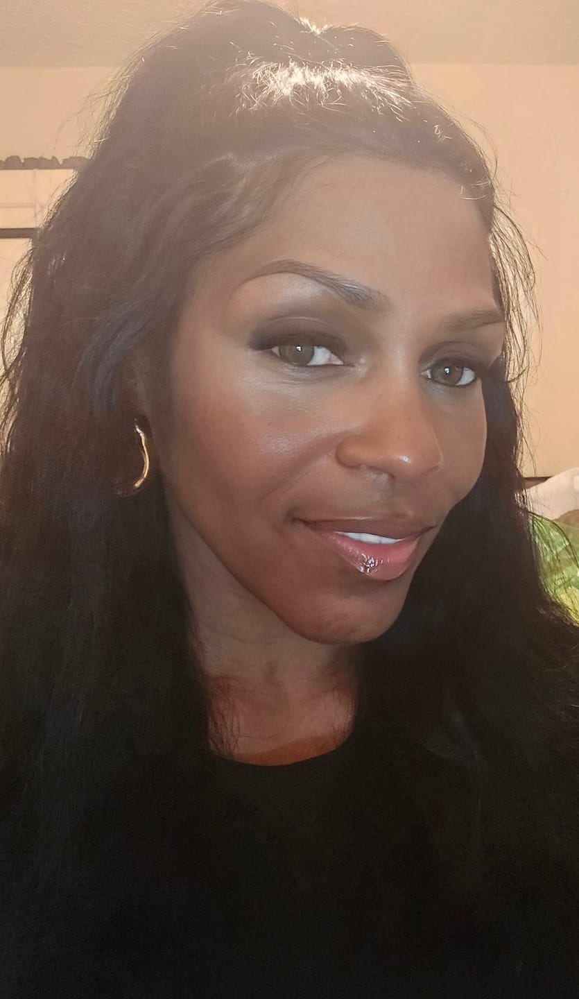 Customer photo review of Sensationnel 13A 100% Virgin Human Hair Glueless 13x4 HD Lace Frontal Wig - STRAIGHT (20"-34") - Pre-Plucked