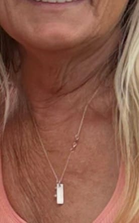 Customer photo review of Body Serum