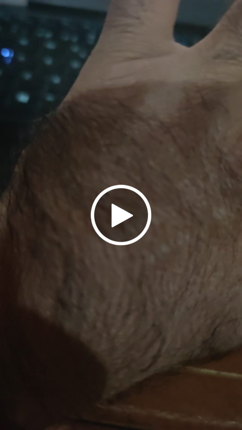 Customer video review of Minoxidil 5 mg con 90 tabletas para 3 meses de tratamiento