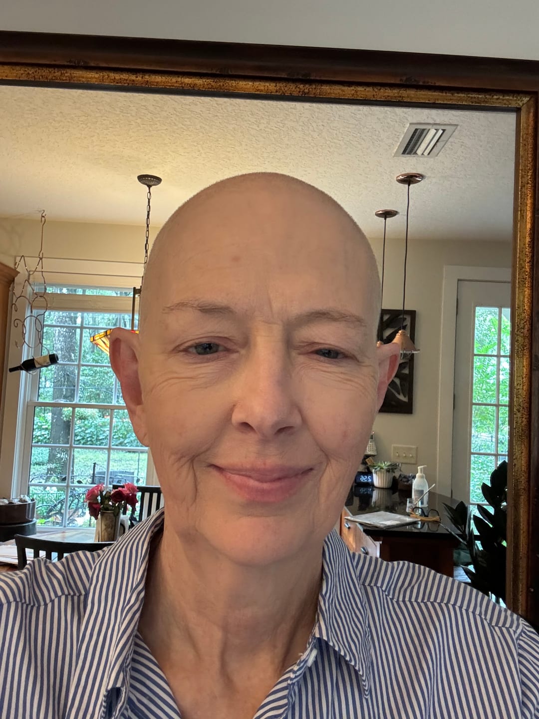 Customer photo review of Chemo Hair and Scalp Care Bundle