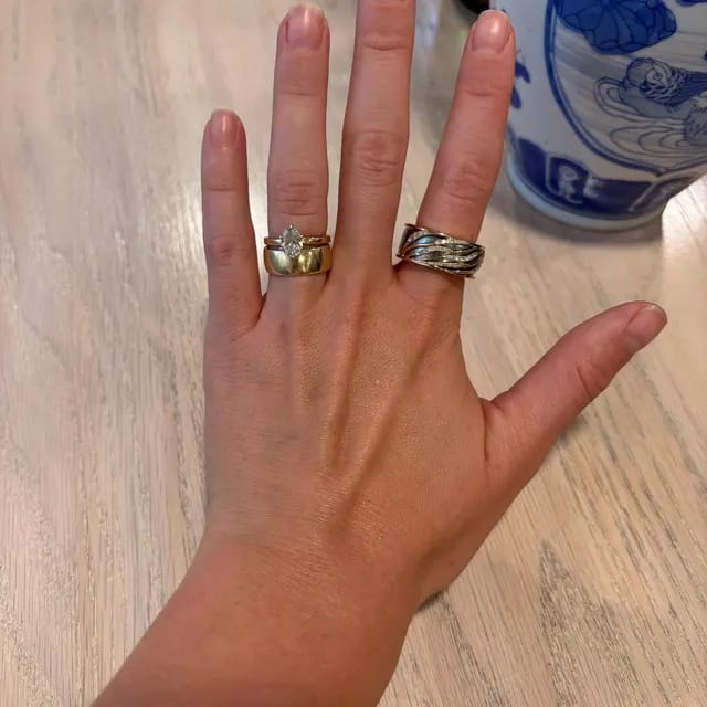 Customer photo review of Wavy Smart Ring Jacket for Oura Ring 4 & 5 Moissanite Ring Cover