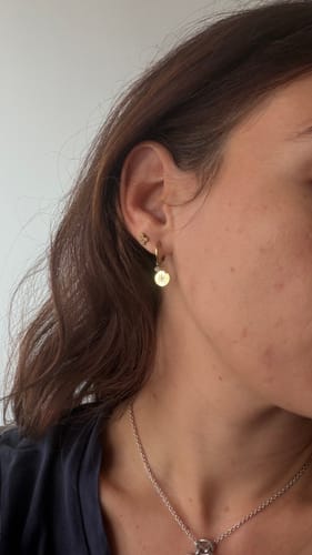 Reviewer's profile view showing clearer skin on cheek after using Pure Glow supplements.