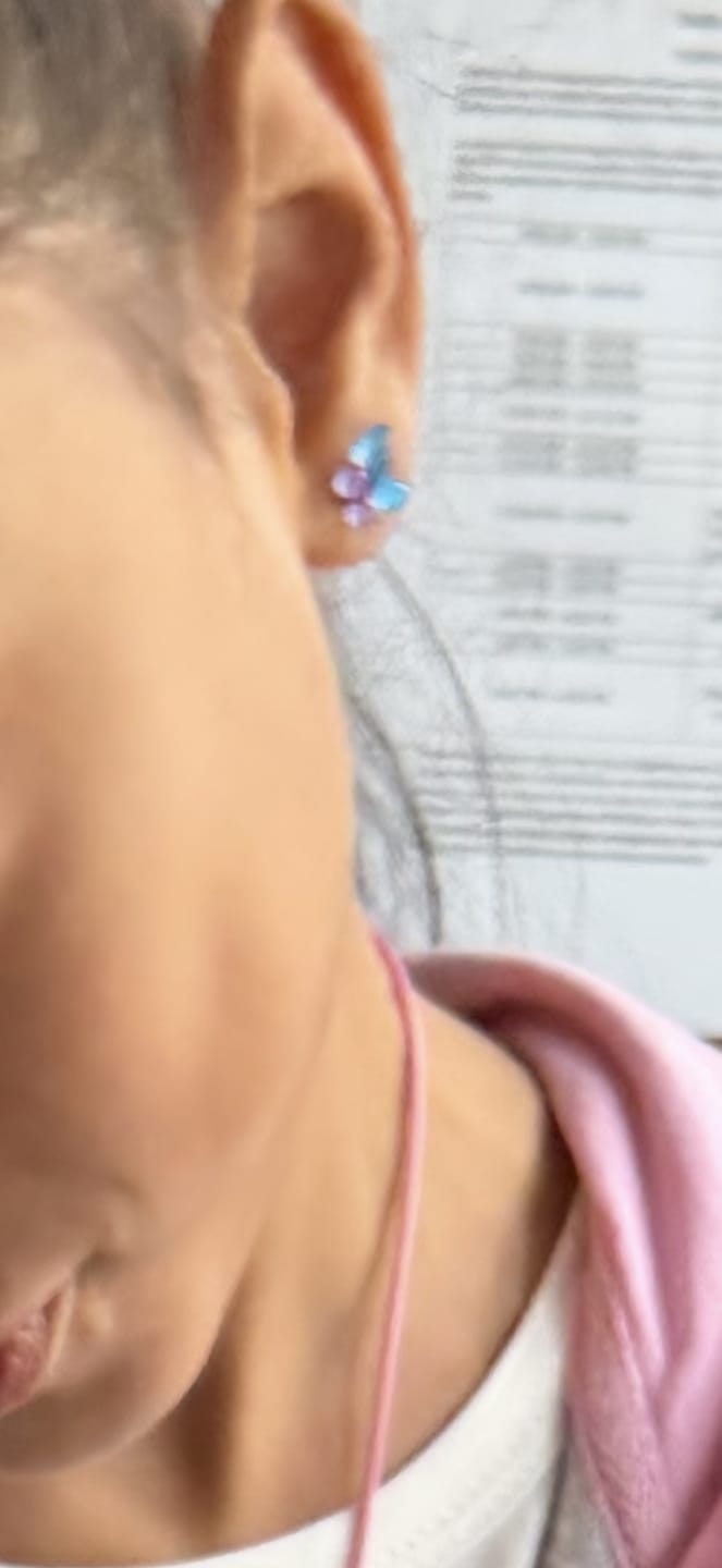 Customer photo review of Glassy Butterfly Studs Hypoallergenic Earrings for Sensitive Ears with Plastic Posts