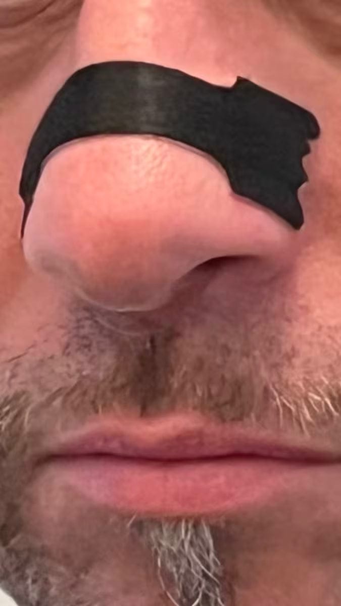 Customer photo review of Nasenpflaster schwarz: für erholsamen Schlaf und Sport