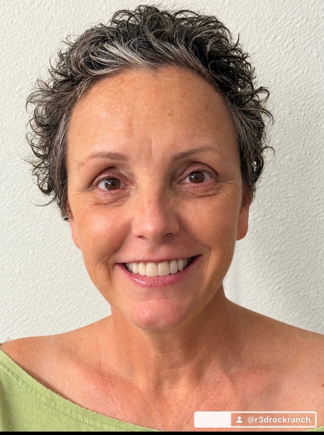 Customer photo review of Hair Growth Hero Bundle