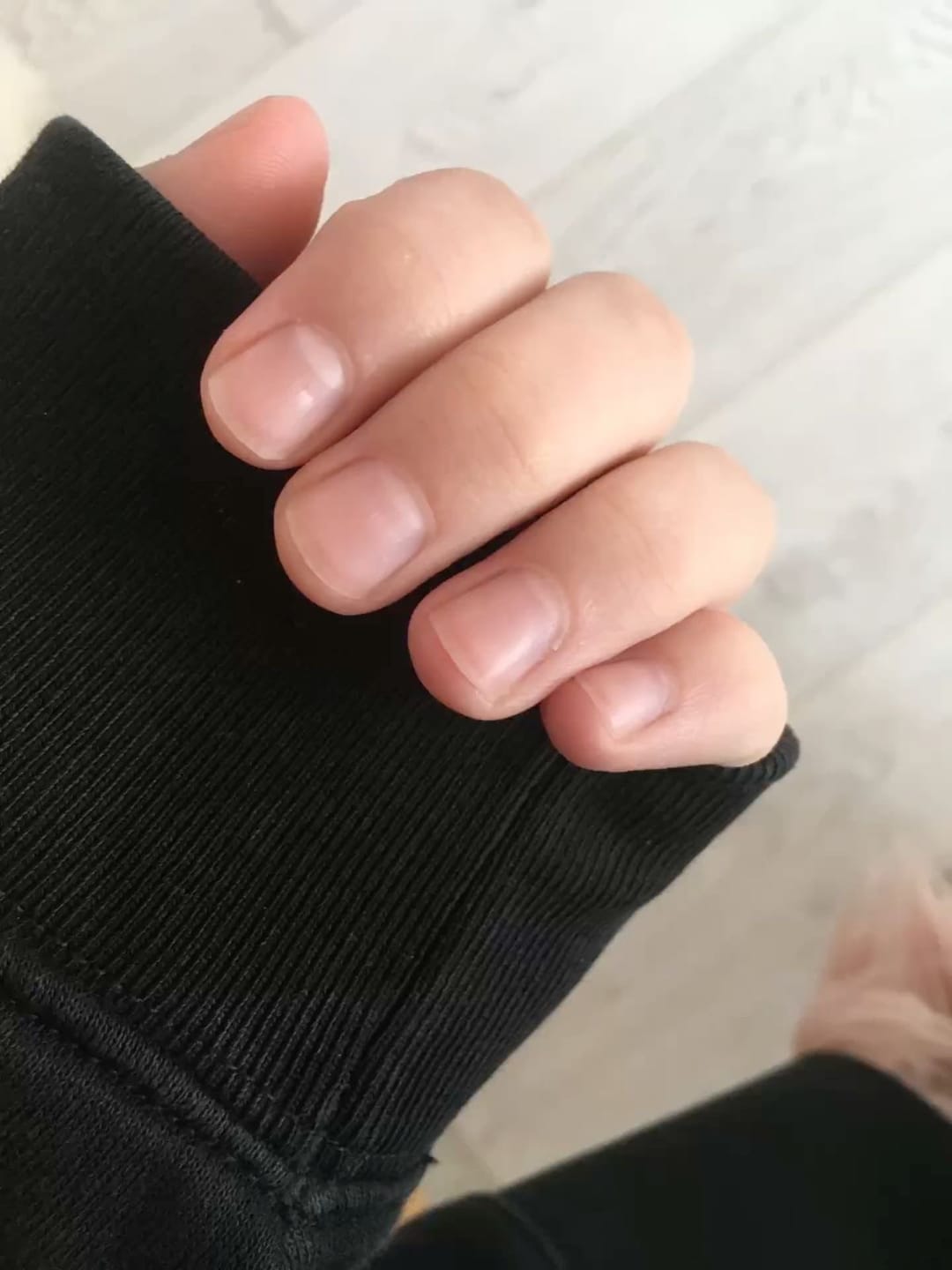 Customer photo review of שמן צמחי לצמיחת הציפורן של NOVELA