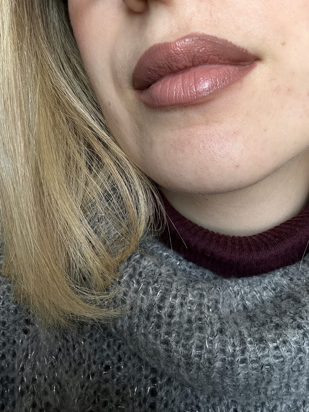 Customer photo review of Lip Contour