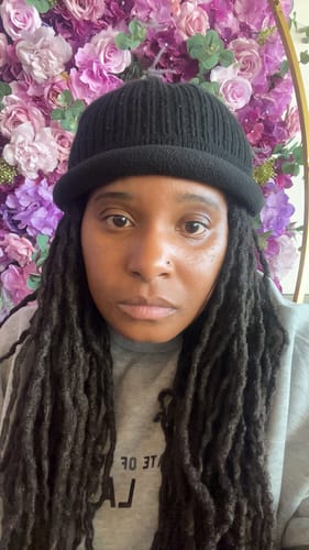 Reviewer's face showing their skin after using the Turmeric Glow Soap.