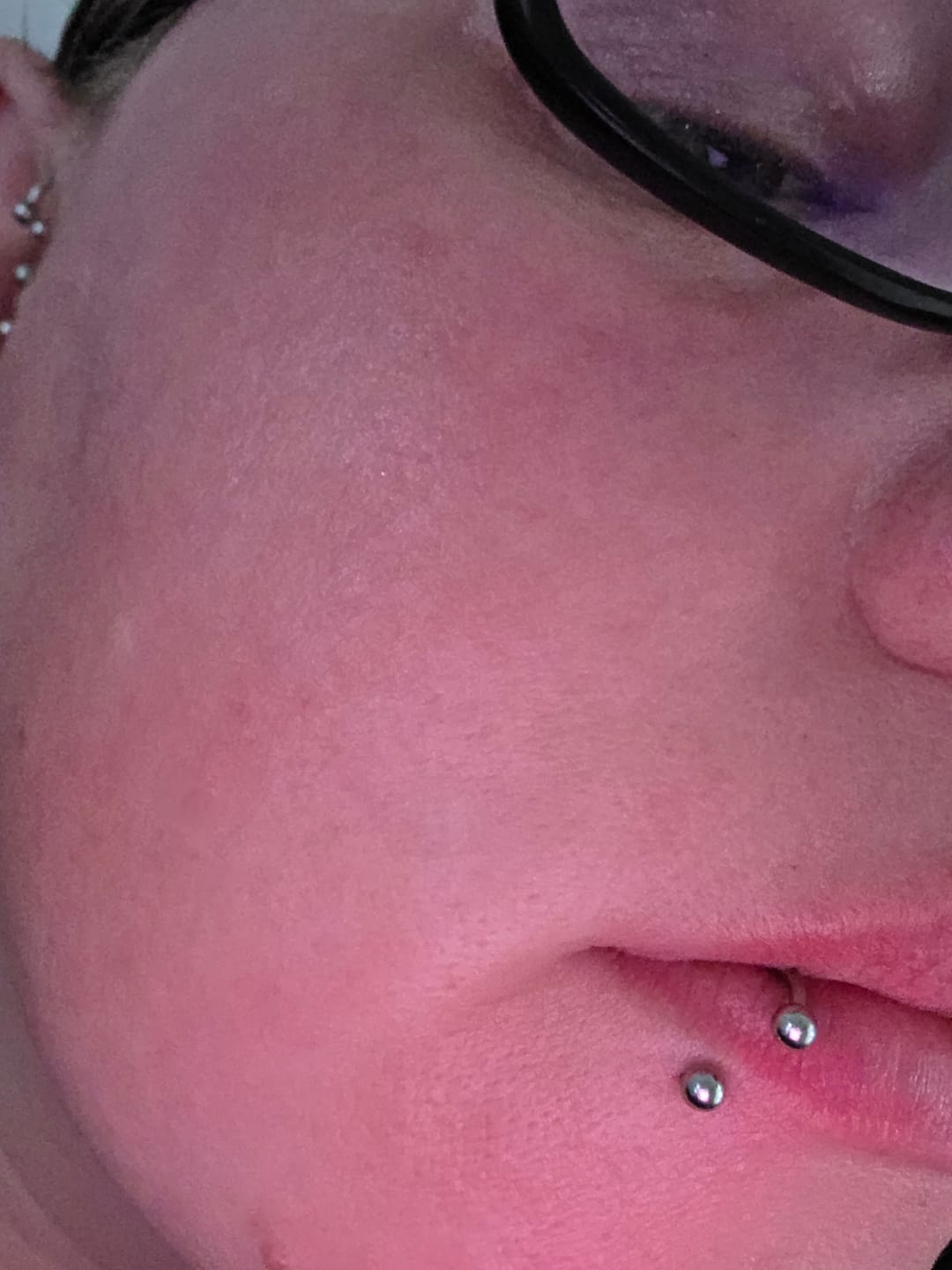 Customer photo review of Suprême Cleansing GEL