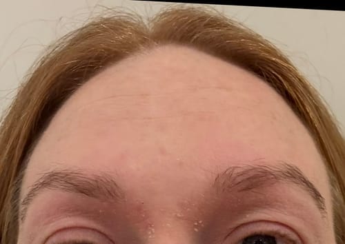 Customer photo review of Seb Natural Calming Serum