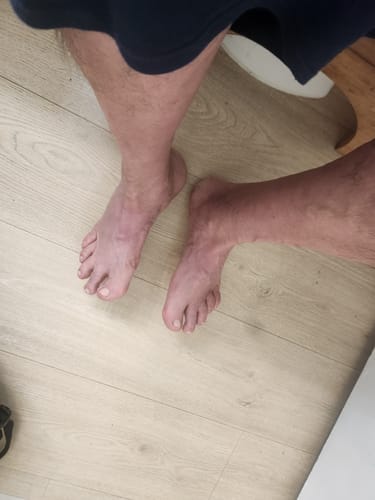 Reviewer's feet and lower legs, an area they treat for pain with Mama Bear Nerve Relief Lotion.