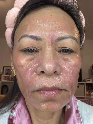 Close-up of a reviewer's face showing shiny, slightly red skin after a Professional Skin Scan.