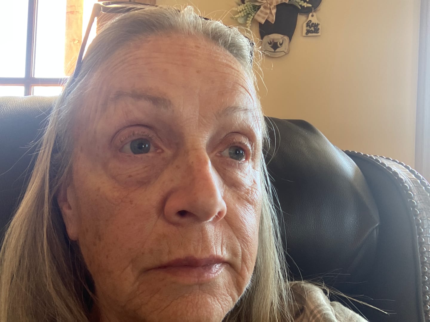 Customer photo review of Micro Infusion Patches