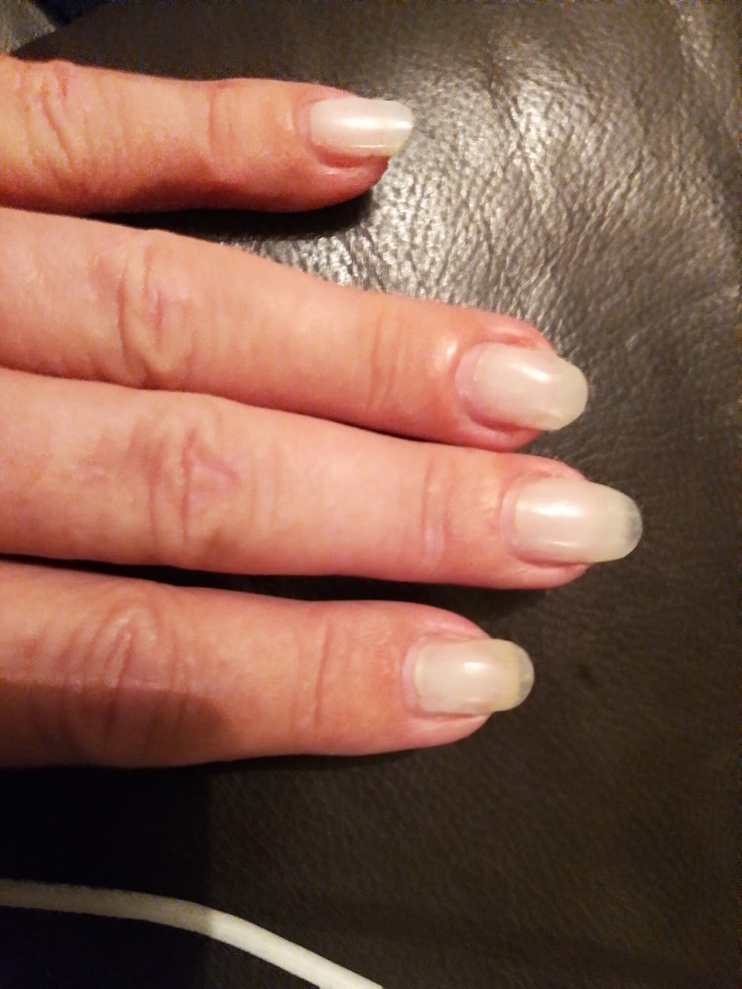 Customer photo review of Crystal Clear DIY Semicured Gel Nail Sticker Kit (STOP NAIL BITING & GROW BRITTLE NAILS)