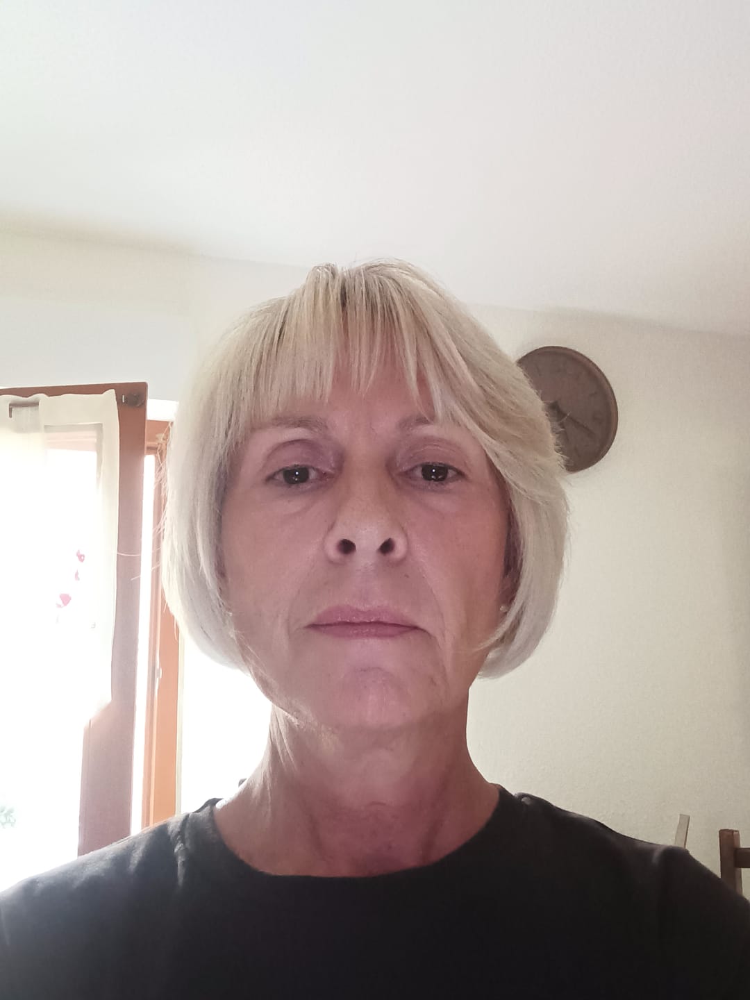Customer photo review of COLLAGÈNE MARIN / ACIDE HYALURONIQUE - 120 GÉLULES