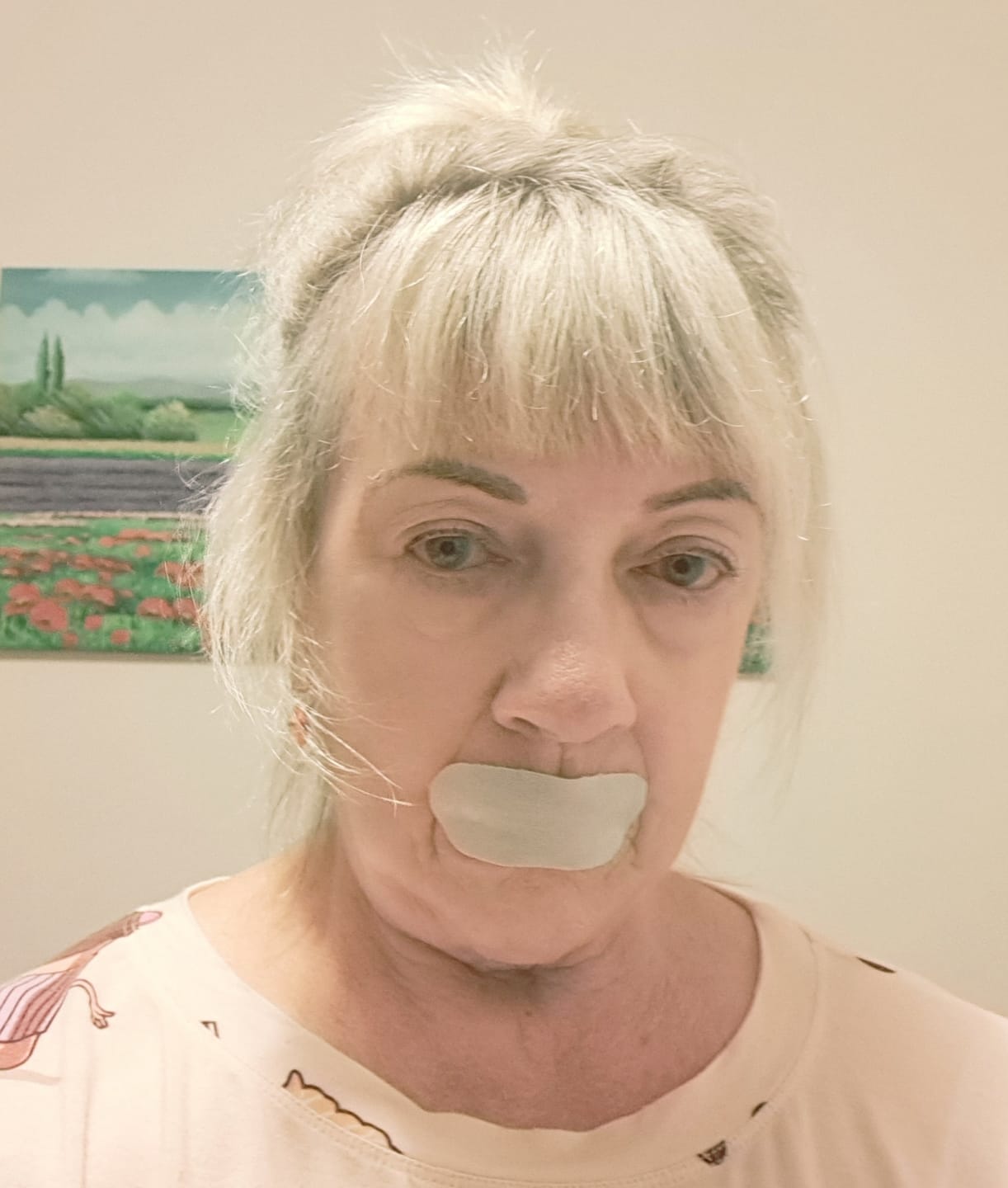 Customer photo review of Respire Sleep Strips