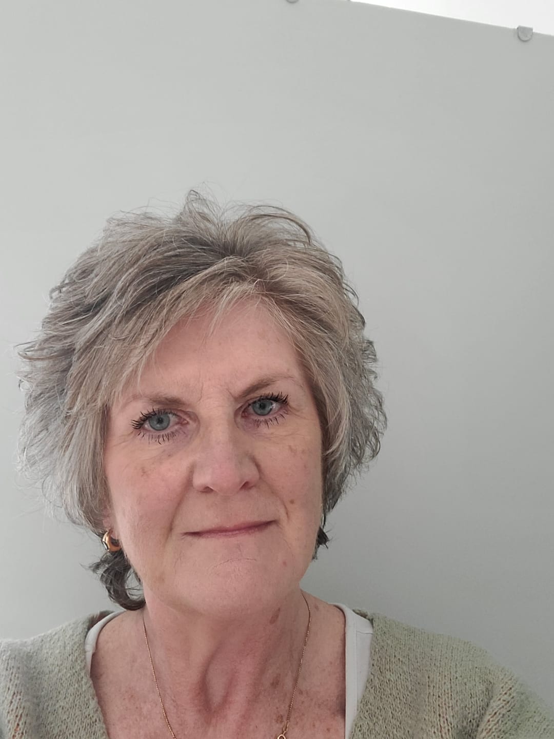 Customer photo review of Rosalique 3 in 1 Anti-Redness Miracle Formula SPF50