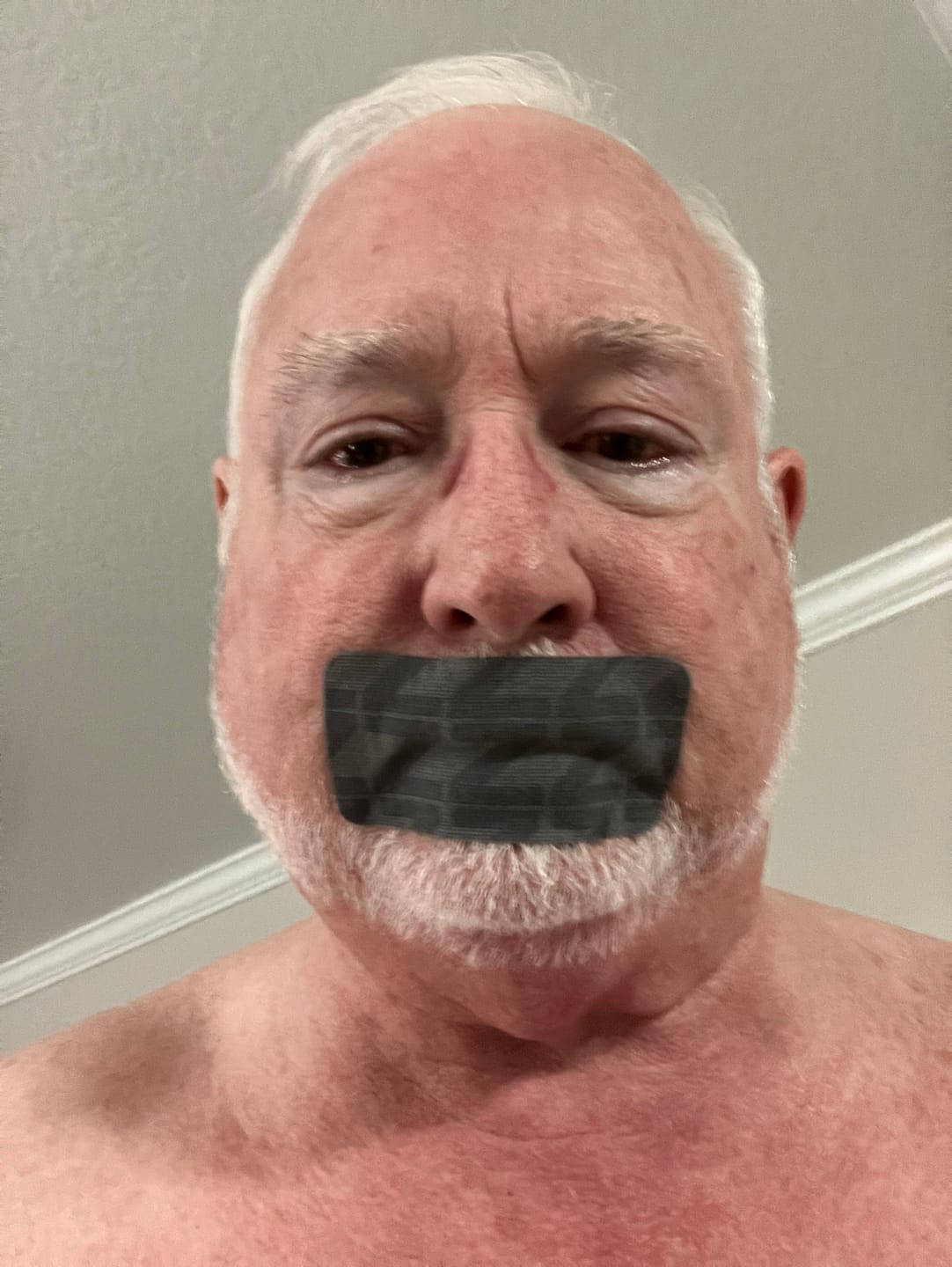 Customer photo review of ZzzTape - Mouth Tape