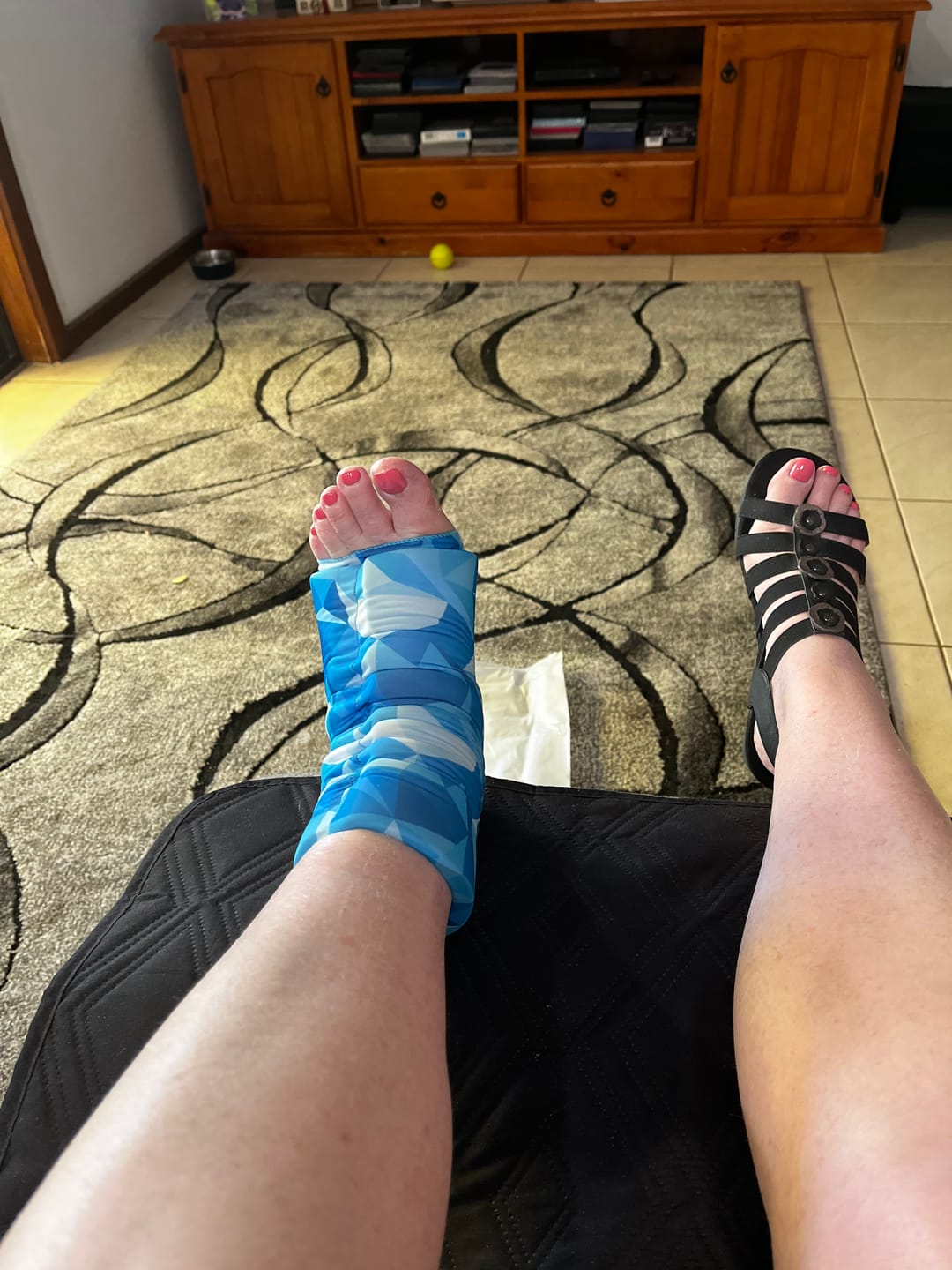 Customer photo review of Small Hot & Cold Compression Gel Sleeves