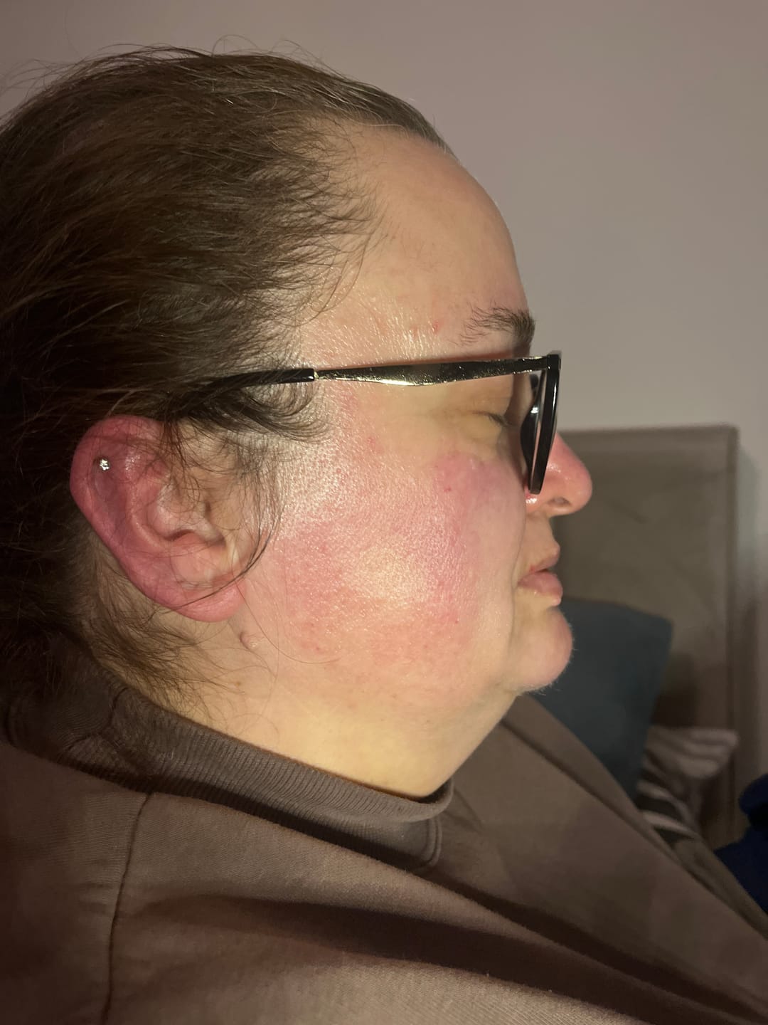 Customer photo review of Anti-Dark Spot Cream
