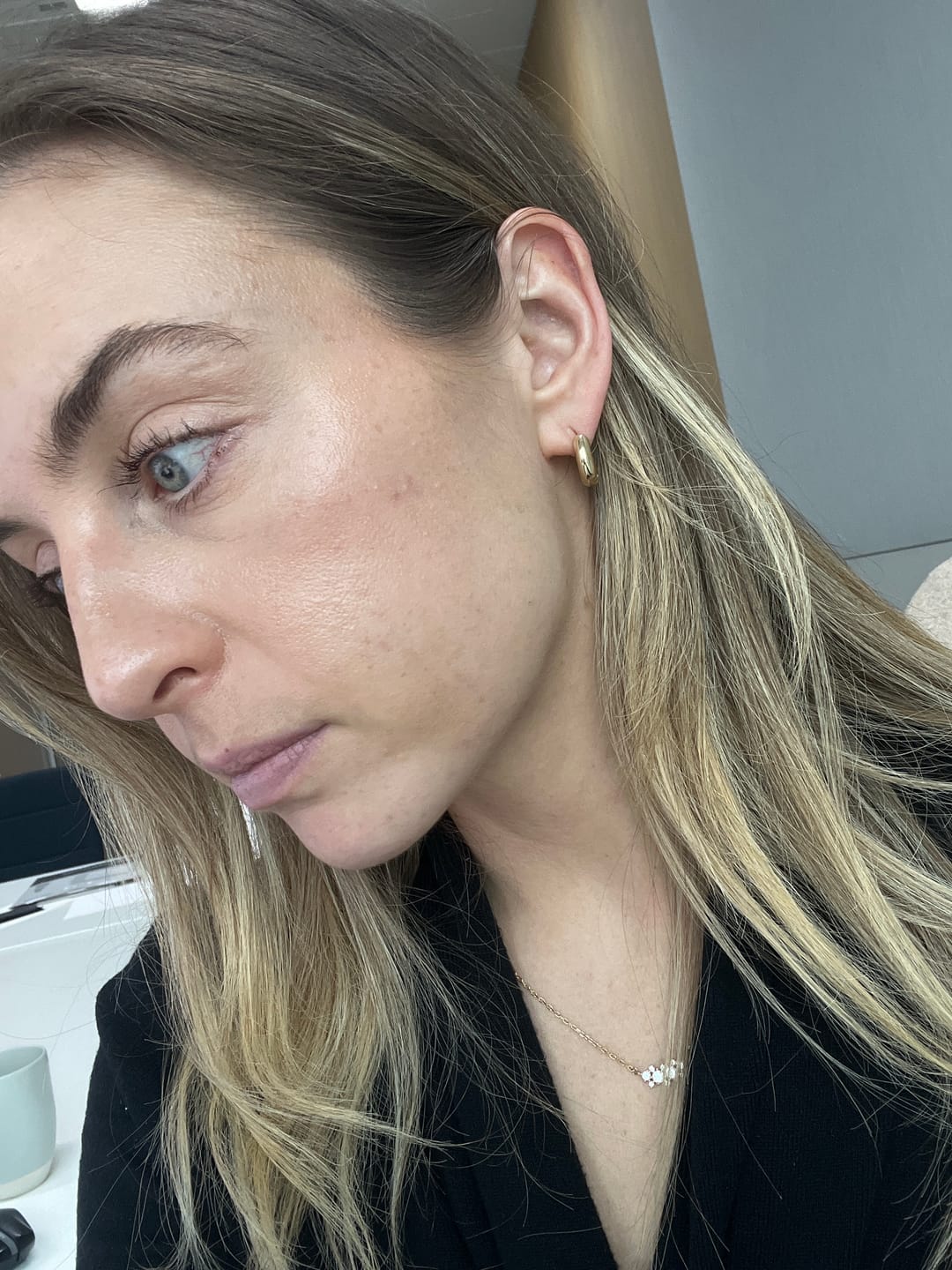 Customer photo review of SkinSpan™ M