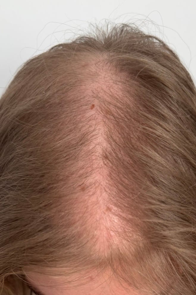 Customer photo review of Complex10™ Hair Growth Supplement