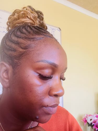 Customer photo review of Minoxidil REGULAR (2%) strength SOLUTION, 1 x 60ml pack