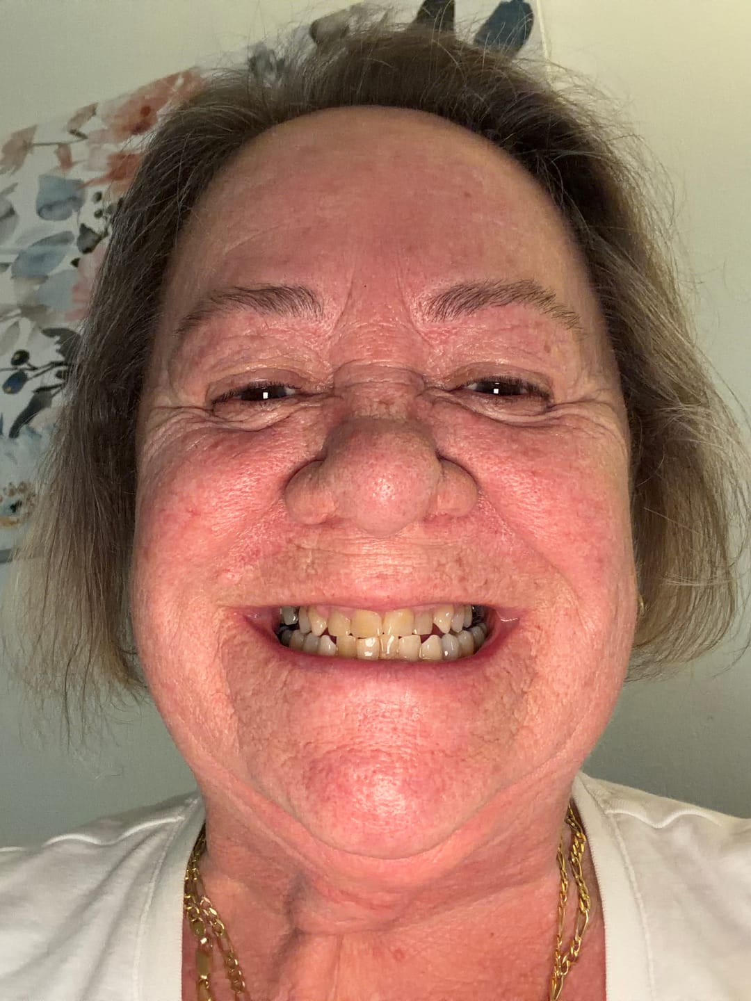 Customer photo review of LivFresh Wintergreen Gel Toothpaste - 4 Pack - FERMAT