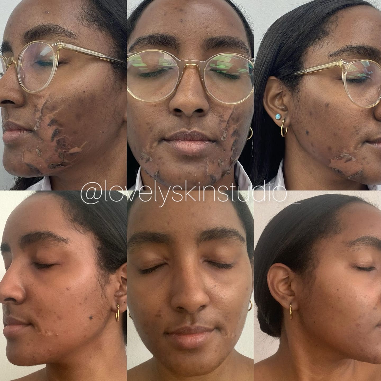 Customer photo review of Zena 100% Organic Algae Peel