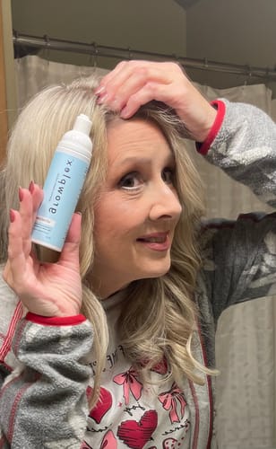 Customer photo review of VITAFOAM ™ Hair Growth Formula