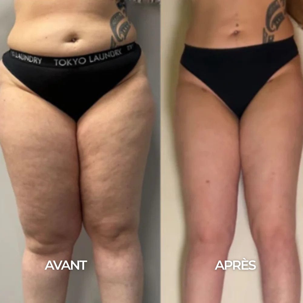 Customer photo review of Gouttes de bien-être pour le drainage lymphatique