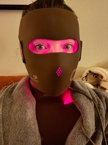 Customer photo review of JOVS 4D Laser Light Therapy Mask