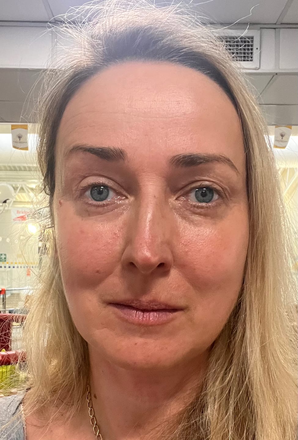 Customer photo review of Rosalique 3 in 1 Anti-Redness Miracle Formula SPF50