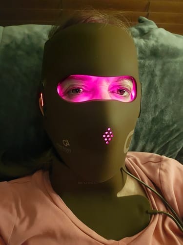 Customer photo review of JOVS 4D Laser Light Therapy Mask
