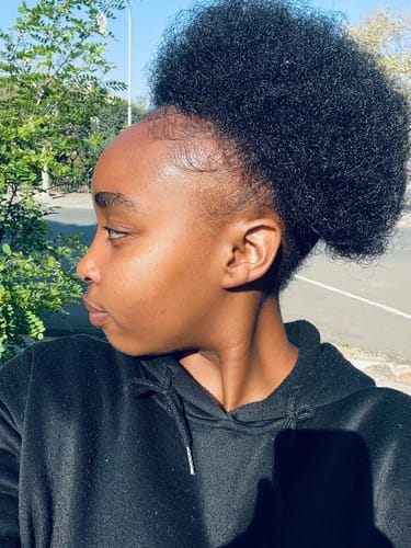 Customer photo review of Minoxidil High Strength (5%) SOLUTION, 3x60ml pack