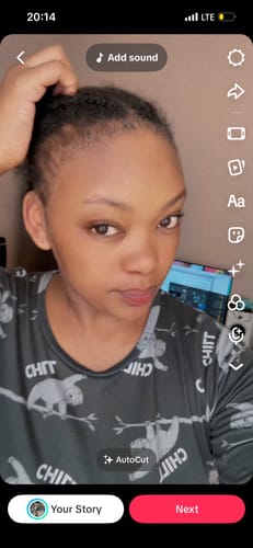 Customer photo review of Minoxidil High Strength (5%) SOLUTION, 3x60ml pack