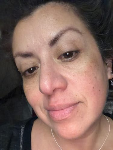 Customer photo review of JOVS 4D Laser Light Therapy Mask