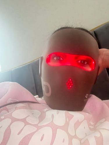 Customer photo review of JOVS 4D Laser Light Therapy Mask