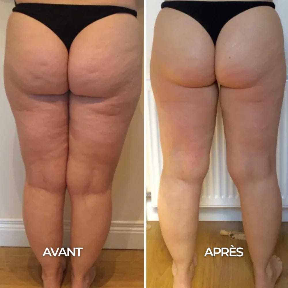 Customer photo review of Gouttes de bien-être pour le drainage lymphatique