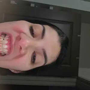 Customer photo review of Viralaluna™ Purple Teeth Whitening Strips