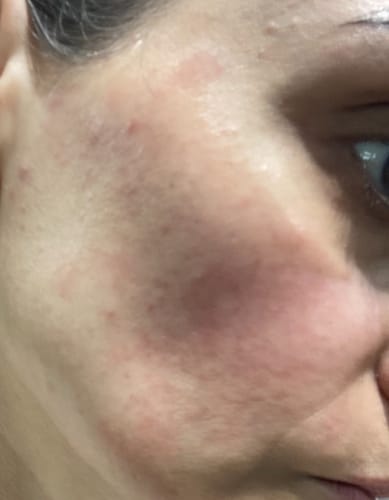 Customer photo review of Seb Natural Calming Serum