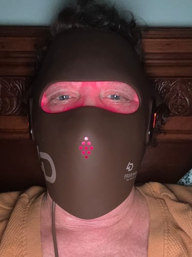 Customer photo review of JOVS 4D Laser Light Therapy Mask