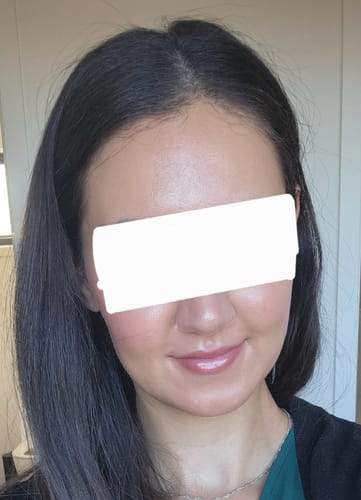 Reviewer showing clear, smooth skin after using the Intermediate Acne Program™ to treat her acne.