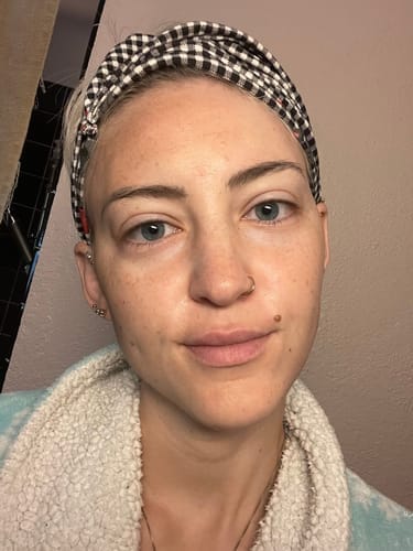 Customer photo review of LIFTEYA® - Effet Lifting Sans Chirurgie