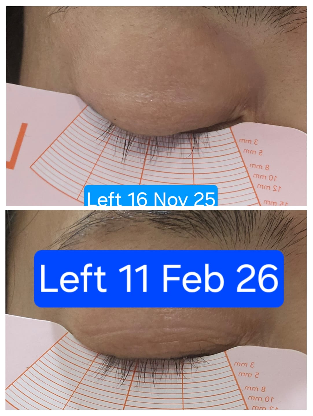Customer photo review of Lash Rehab Eyelash Growth Serum – Clinically Proven (3ml)