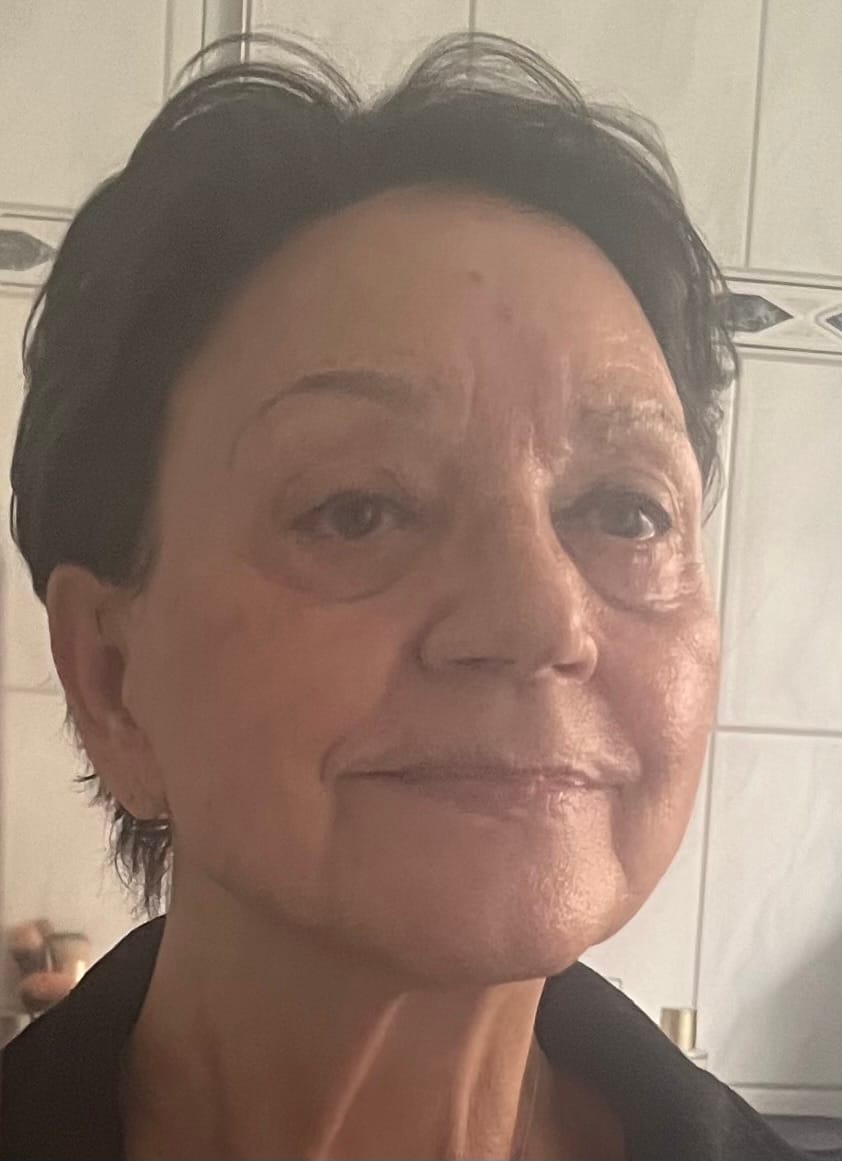 Customer photo review of Tallow Rindertalg Creme Natur – 100% natürliche und unparfümierte Hautpflege
