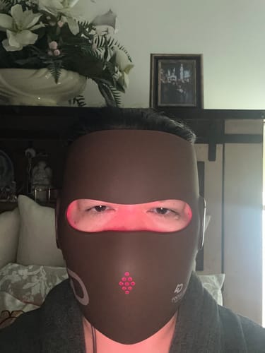 Customer photo review of JOVS 4D Laser Light Therapy Mask