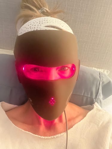 Customer photo review of JOVS 4D Laser Light Therapy Mask